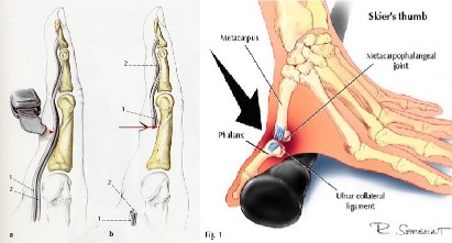 Lesioni Traumatiche e Legamentose